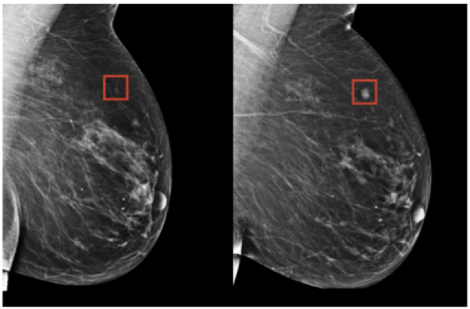 MachineLearning Applied to Medical Diagnosis 1